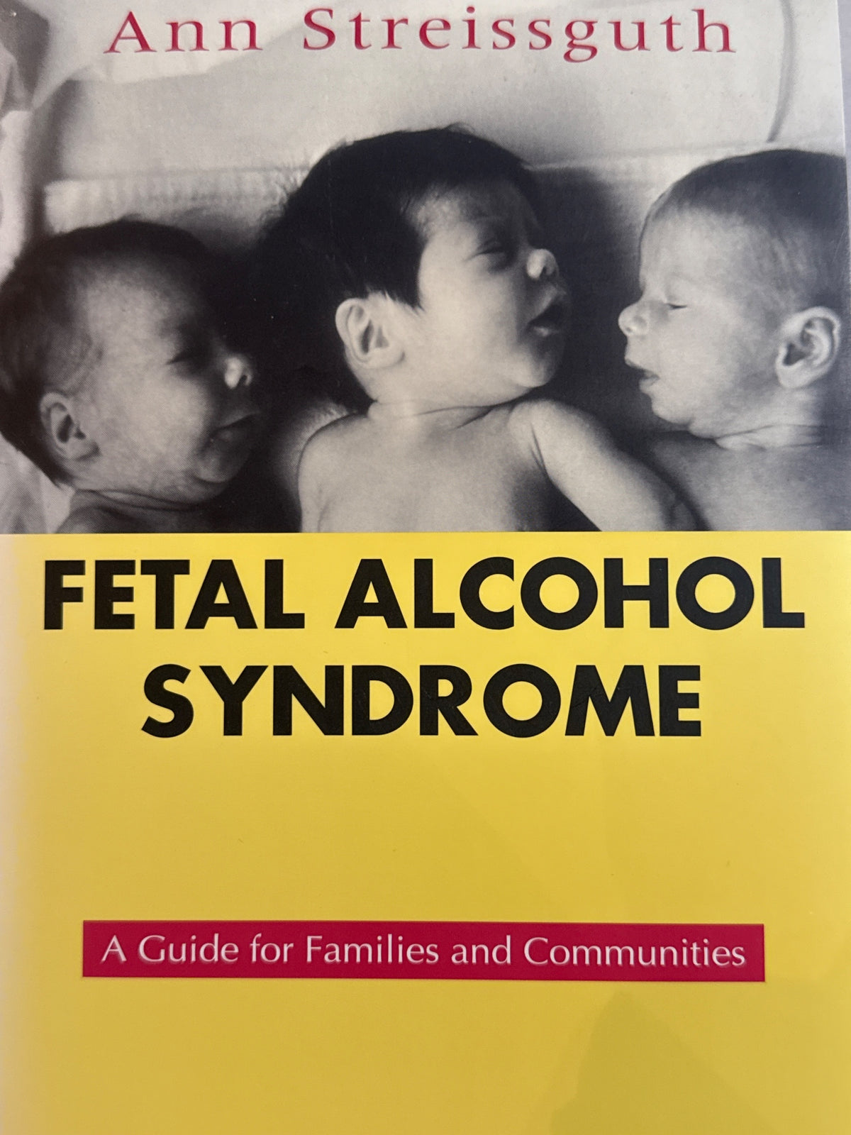 Forside av Fetal Alcohol Syndrome av Ann Pytkowicz Streissguth 